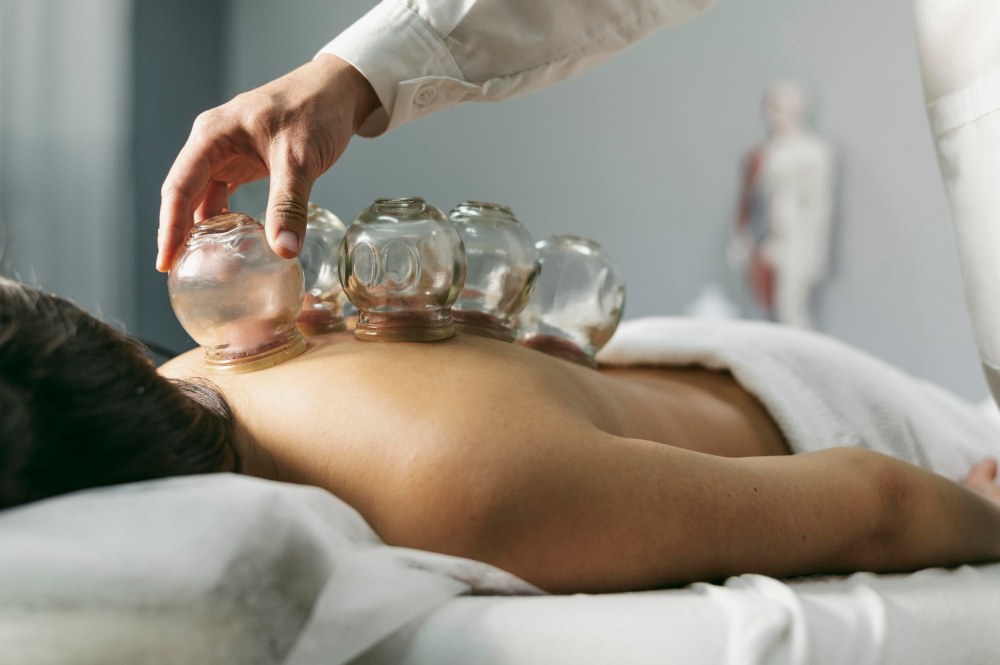Hijama – Cupping Therapy